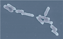 Ăn chất thải từ pin cũ, loại vi khuẩn độc đáo mở ra giải pháp mới tự tái chế pin